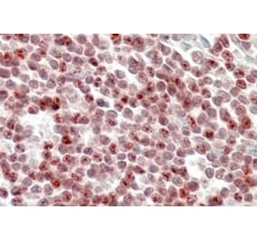 Immunohistochemistry - Anti-SP110 Antibody (A326301) - Antibodies.com