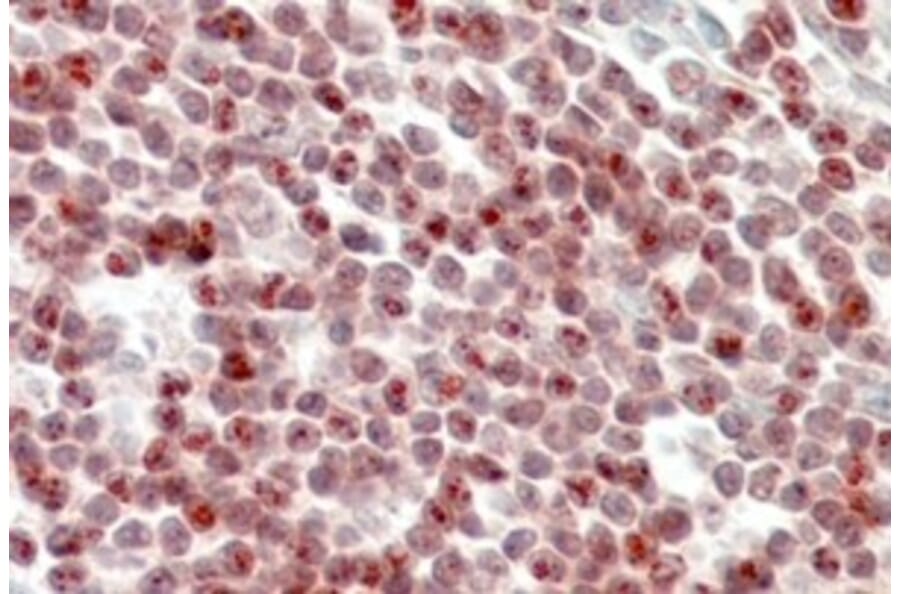 Immunohistochemistry - Anti-SP110 Antibody (A326301) - Antibodies.com