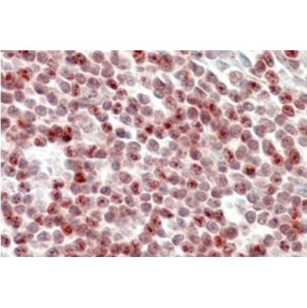 Immunohistochemistry - Anti-SP110 Antibody (A326301) - Antibodies.com