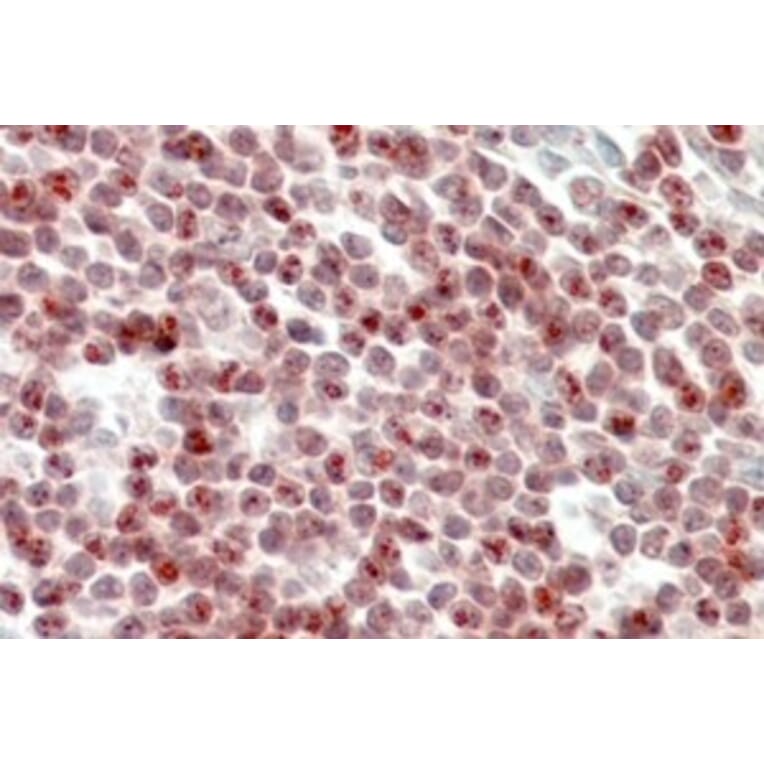 Immunohistochemistry - Anti-SP110 Antibody (A326301) - Antibodies.com
