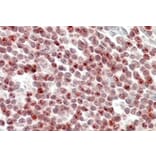 Immunohistochemistry - Anti-SP110 Antibody (A326301) - Antibodies.com