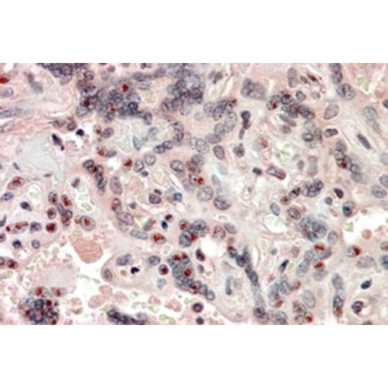 Immunohistochemistry - Anti-NCOA3 Antibody (A326302) - Antibodies.com