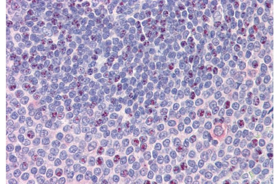 Immunohistochemistry - Anti-NCOA3 Antibody (A326302) - Antibodies.com