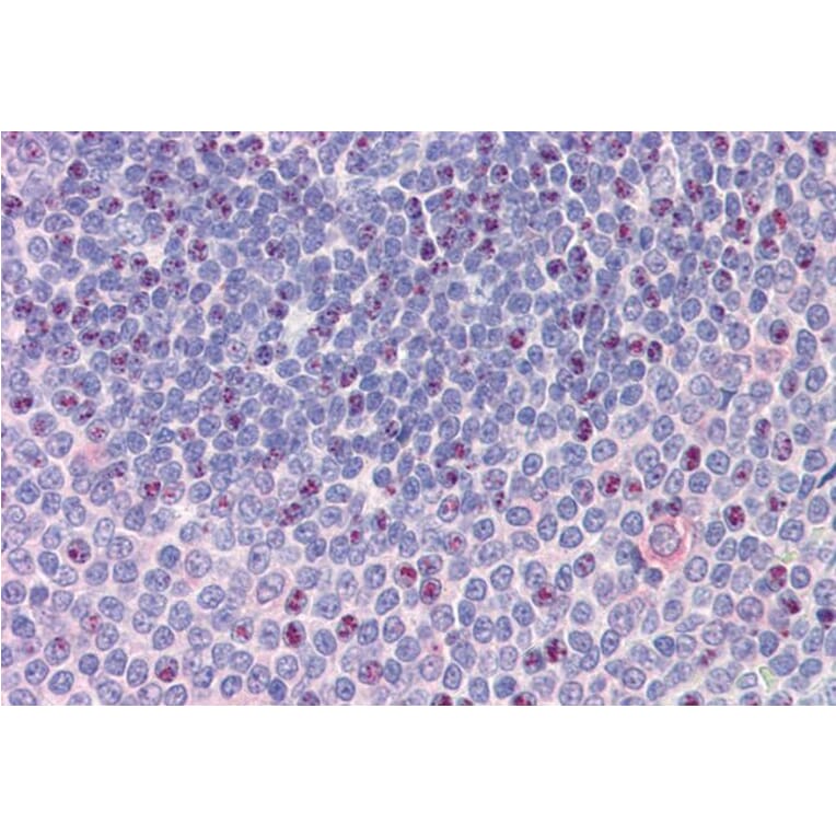 Immunohistochemistry - Anti-NCOA3 Antibody (A326302) - Antibodies.com