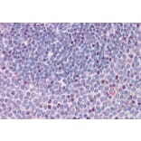 Immunohistochemistry - Anti-NCOA3 Antibody (A326302) - Antibodies.com