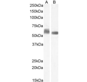 Western Blot - Anti-STAM1 Antibody (A326303) - Antibodies.com