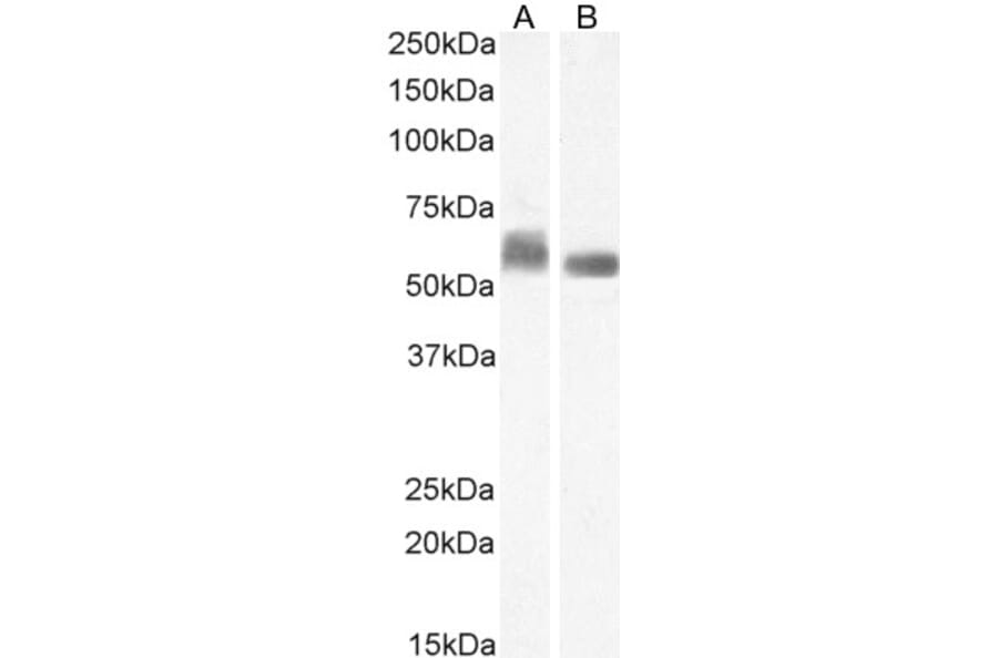 Western Blot - Anti-STAM1 Antibody (A326303) - Antibodies.com