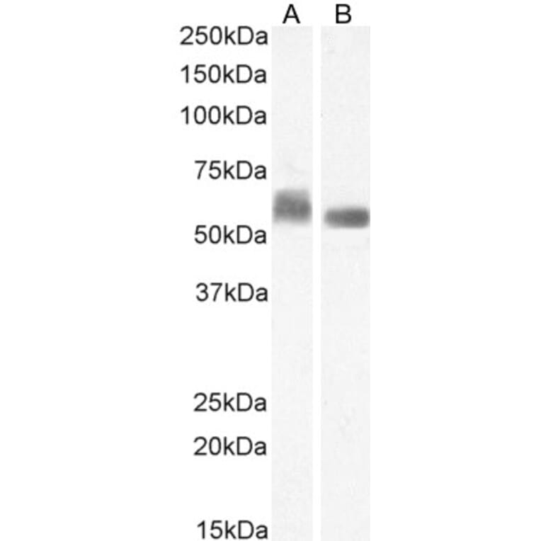 Western Blot - Anti-STAM1 Antibody (A326303) - Antibodies.com