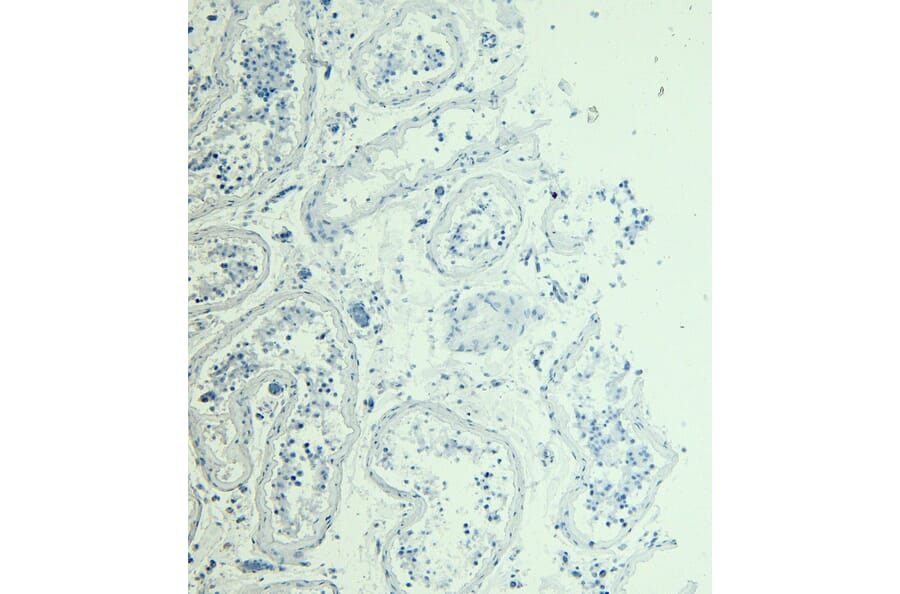 Immunohistochemistry - Anti-STAM1 Antibody (A326303) - Antibodies.com