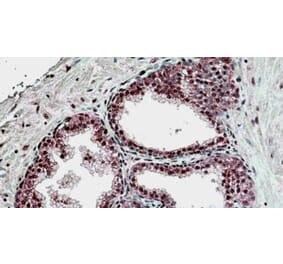 Immunohistochemistry - Anti-SUFU Antibody (A326304) - Antibodies.com