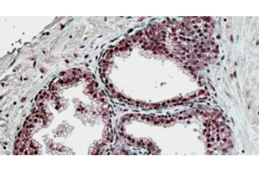 Immunohistochemistry - Anti-SUFU Antibody (A326304) - Antibodies.com