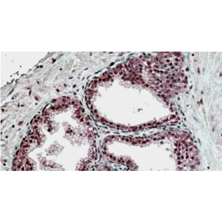 Immunohistochemistry - Anti-SUFU Antibody (A326304) - Antibodies.com