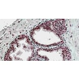 Immunohistochemistry - Anti-SUFU Antibody (A326304) - Antibodies.com