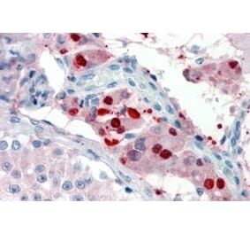 Immunohistochemistry - Anti-ZBTB7B Antibody (A326306) - Antibodies.com