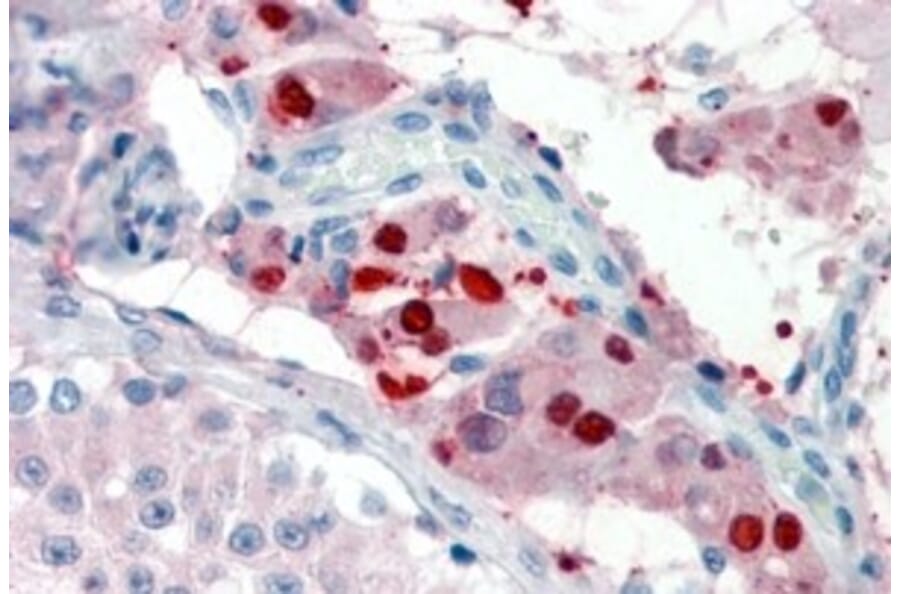 Immunohistochemistry - Anti-ZBTB7B Antibody (A326306) - Antibodies.com