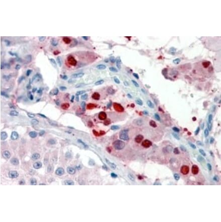 Immunohistochemistry - Anti-ZBTB7B Antibody (A326306) - Antibodies.com