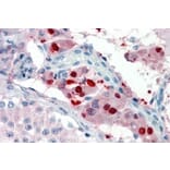 Immunohistochemistry - Anti-ZBTB7B Antibody (A326306) - Antibodies.com