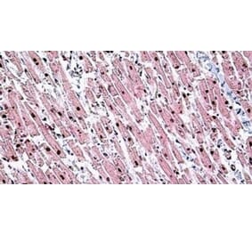 Immunohistochemistry - Anti-Tin2 Antibody (A326307) - Antibodies.com