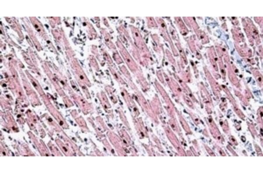 Immunohistochemistry - Anti-Tin2 Antibody (A326307) - Antibodies.com