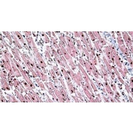 Immunohistochemistry - Anti-Tin2 Antibody (A326307) - Antibodies.com