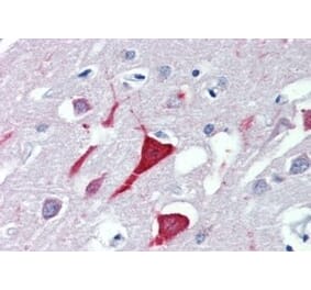 Immunohistochemistry - Anti-USP9X Antibody (A326309) - Antibodies.com