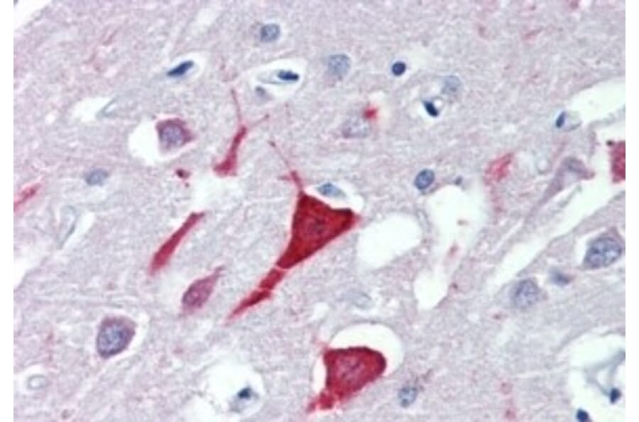 Immunohistochemistry - Anti-USP9X Antibody (A326309) - Antibodies.com