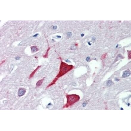 Immunohistochemistry - Anti-USP9X Antibody (A326309) - Antibodies.com