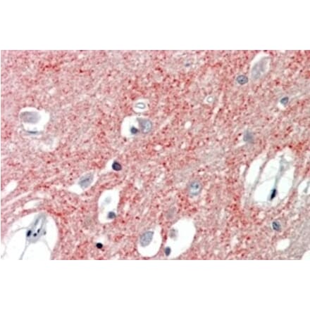 Immunohistochemistry - Anti-VGLUT1 Antibody (A326310) - Antibodies.com