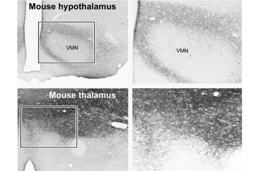 IHC of mouse hypothalamus and thalamus using Anti-VGluT1 Antibody (A326310)