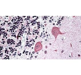 Immunohistochemistry - Anti-WBP1 Antibody (A326311) - Antibodies.com
