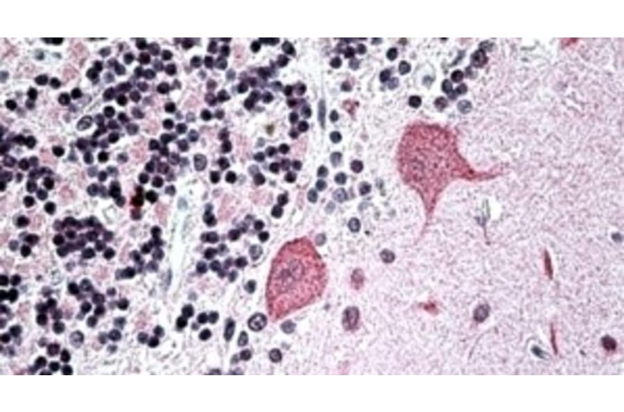 Immunohistochemistry - Anti-WBP1 Antibody (A326311) - Antibodies.com