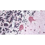 Immunohistochemistry - Anti-WBP1 Antibody (A326311) - Antibodies.com