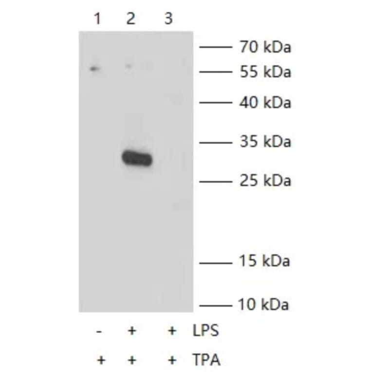 IL-1 beta KO Validation - Human IL-1 beta ELISA Kit (High Sensitivity) (A326656) - Antibodies.com