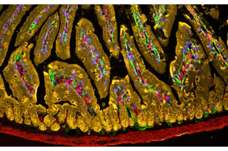 Immunohistochemistry - StreptaClick® HRP Complete Tyramide Signal Amplification and Biotinylation Kit - 3 Color (A329040) - Antibodies.com