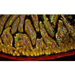 Immunohistochemistry - Tyramide Signal Amplification Kit - 3 Color (A329042) - Antibodies.com