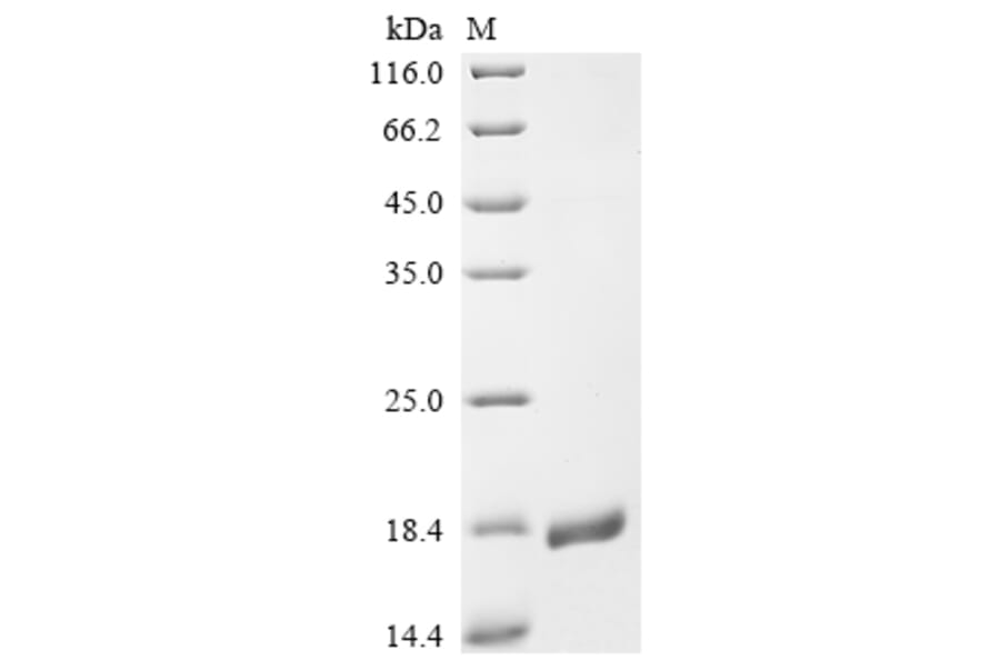 Western Blot - Recombinant Monkeypox Virus A30L Protein (N-Terminal 6x His Tag) (A329045) - Antibodies.com