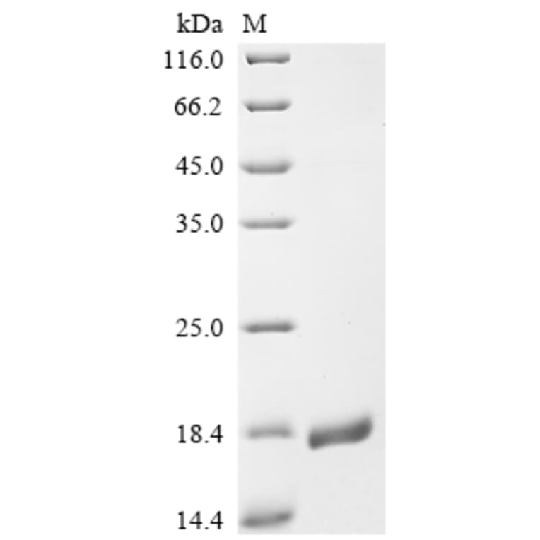 Western Blot - Recombinant Monkeypox Virus A30L Protein (N-Terminal 6x His Tag) (A329045) - Antibodies.com