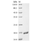 Western Blot - Recombinant Monkeypox Virus A30L Protein (N-Terminal 6x His Tag) (A329045) - Antibodies.com