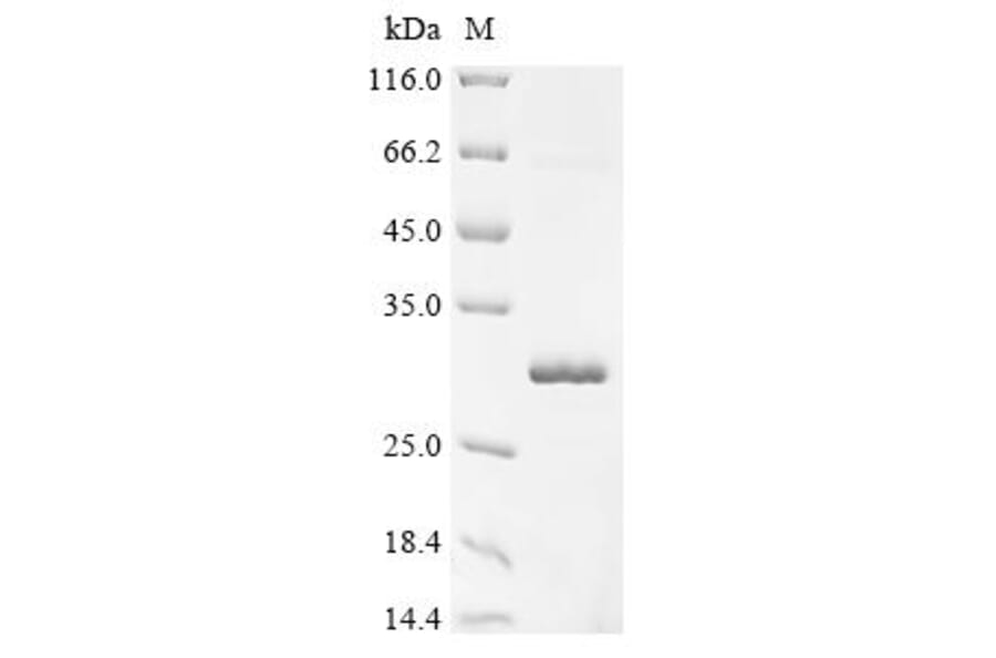 Western Blot - Recombinant Monkeypox Virus A46R Protein (N-Terminal 6x His-SUMO Tag) (A329047) - Antibodies.com