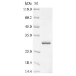 Western Blot - Recombinant Monkeypox Virus A46R Protein (N-Terminal 6x His-SUMO Tag) (A329047) - Antibodies.com