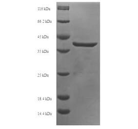 Western Blot - Recombinant Human APOBEC3A Protein (N-Terminal 6x His-SUMO Tag) (A329055) - Antibodies.com