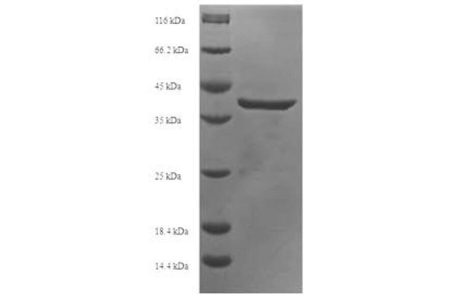 Western Blot - Recombinant Human APOBEC3A Protein (N-Terminal 6x His-SUMO Tag) (A329055) - Antibodies.com