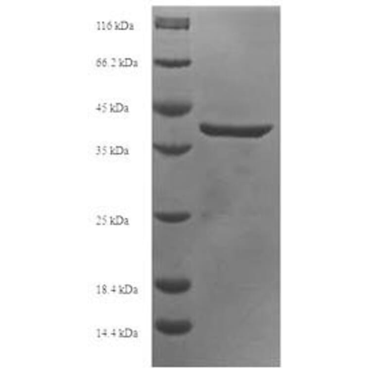 Western Blot - Recombinant Human APOBEC3A Protein (N-Terminal 6x His-SUMO Tag) (A329055) - Antibodies.com