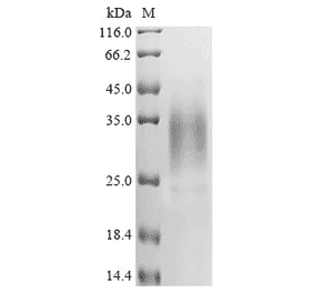 Western Blot - Recombinant Human APOBEC3A Protein (C-Terminal 6x His Tag) (A329056) - Antibodies.com