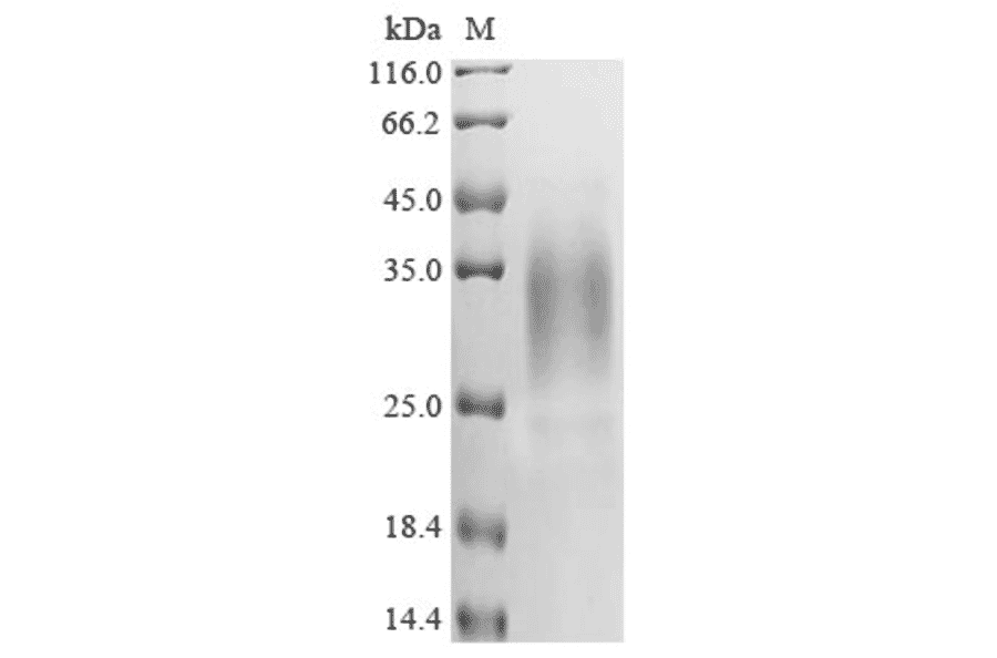 Western Blot - Recombinant Human APOBEC3A Protein (C-Terminal 6x His Tag) (A329056) - Antibodies.com