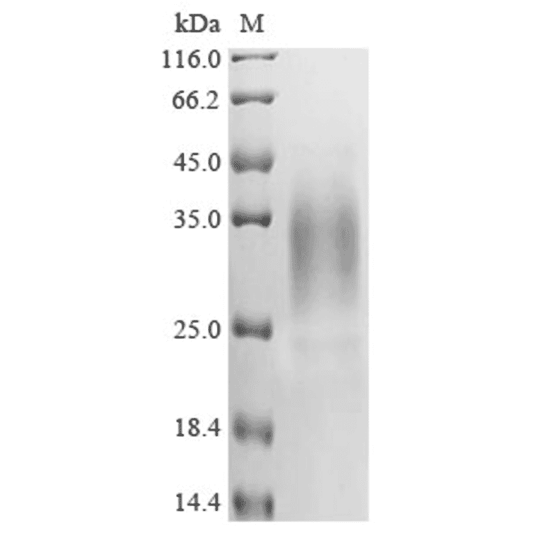 Western Blot - Recombinant Human APOBEC3A Protein (C-Terminal 6x His Tag) (A329056) - Antibodies.com