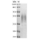 Western Blot - Recombinant Human APOBEC3A Protein (C-Terminal 6x His Tag) (A329056) - Antibodies.com