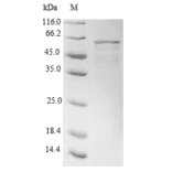 Western Blot - Recombinant Human APOBEC3G Protein (N-Terminal 6x His-SUMO Tag) (A329058) - Antibodies.com