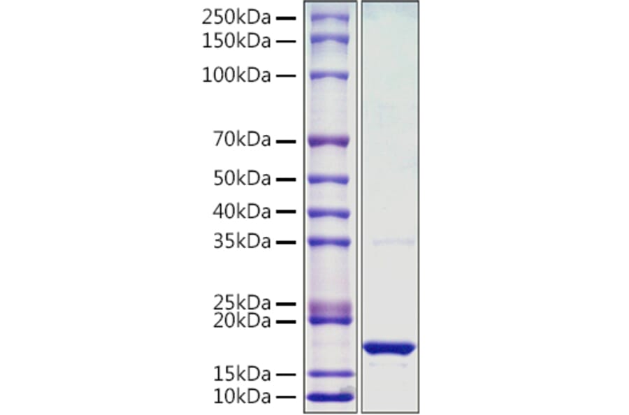 SDS-PAGE - Recombinant Monkeypox virus L1R Protein (C-terminal His Tag) (A329067) - Antibodies.com