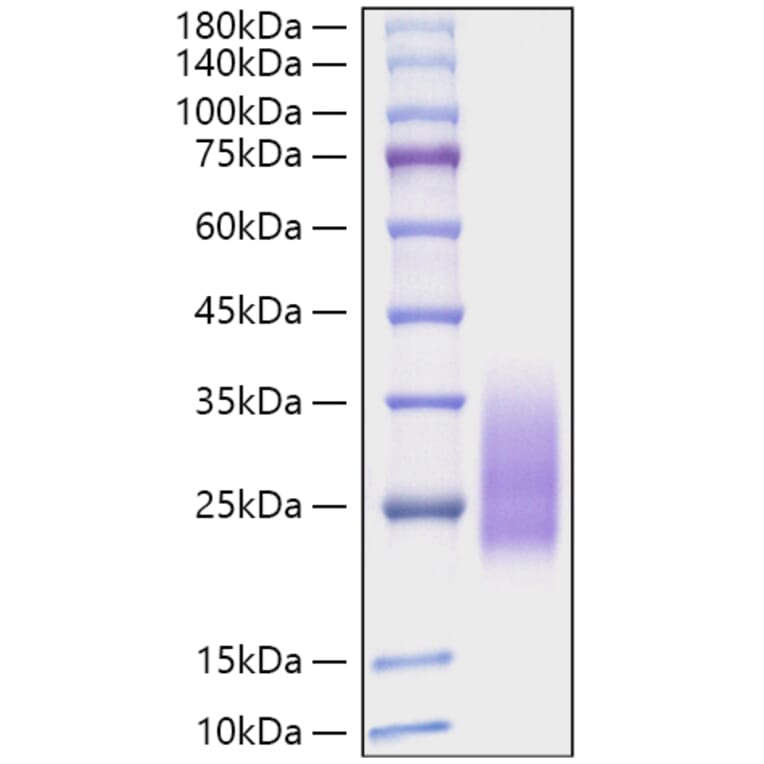 SDS-PAGE - Recombinant Monkeypox virus A30L Protein (C-terminal His Tag) (A329069) - Antibodies.com